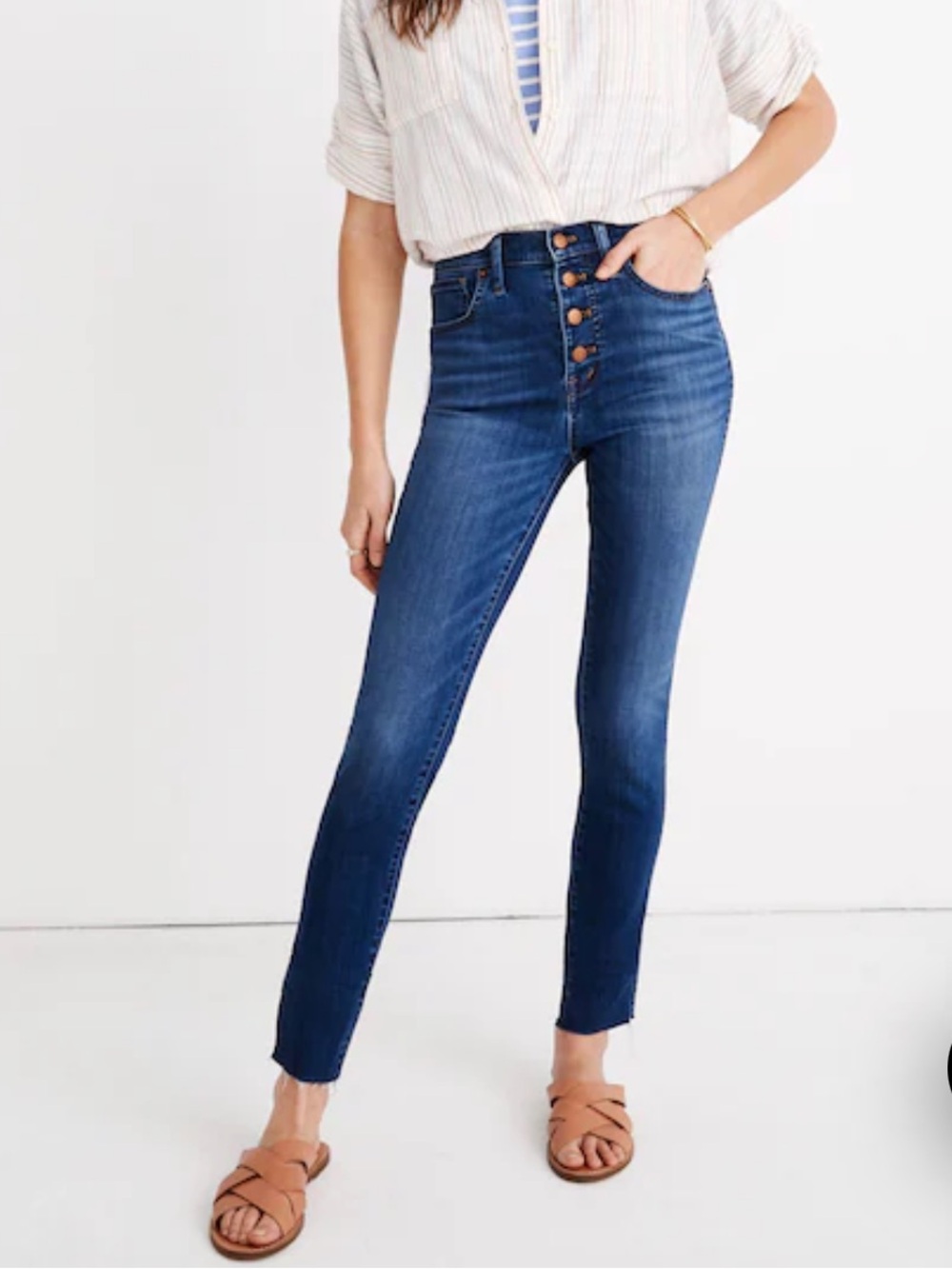 Madewell // 10" High-Rise Skinny Crop Jeans: Button-Front Edition